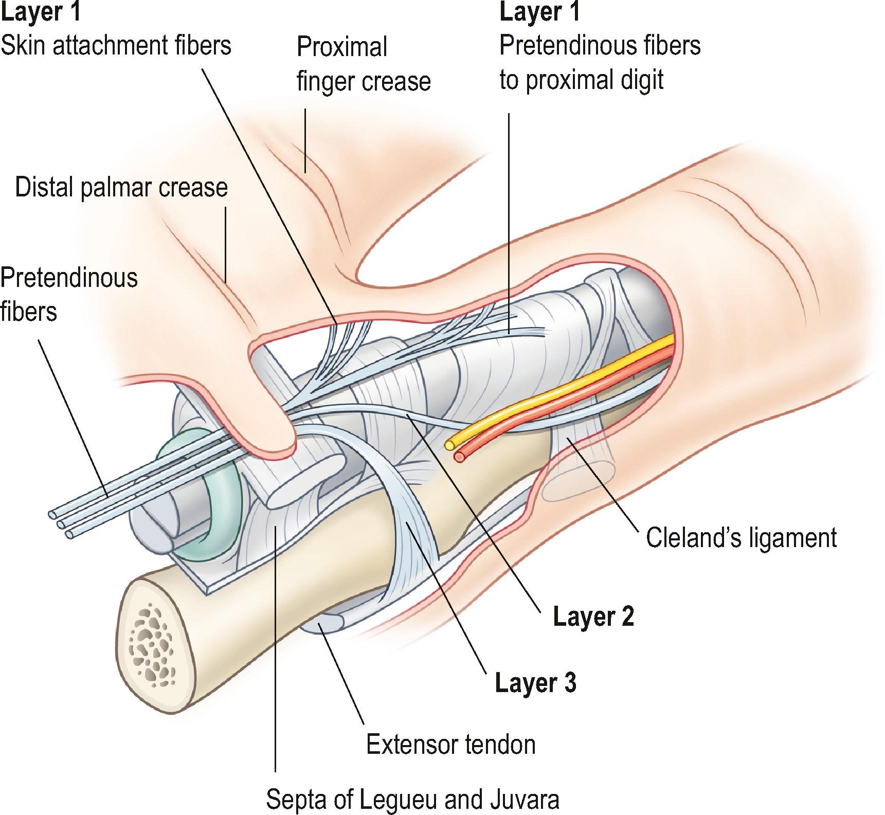 Figure 17.8, Division of pretendinous band in three layers.