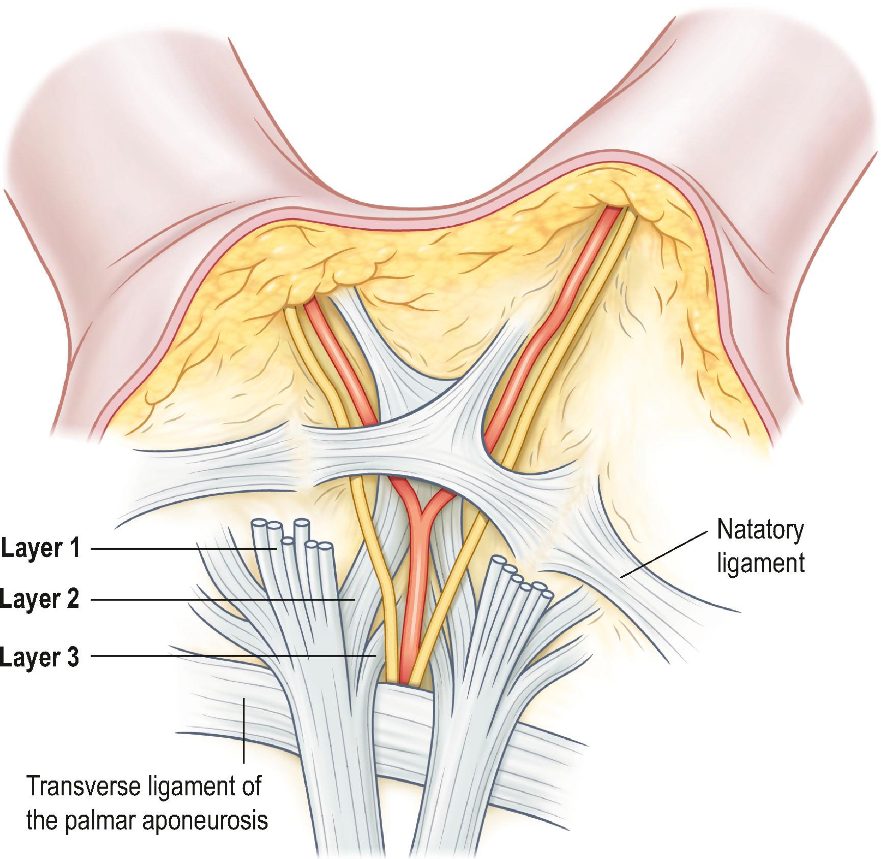 Figure 17.10, Schematic drawing of the relevant palmar fascial structures at the palmodigital junction. The pretendinous fibers can be seen to divide in three layers. Layer 2, the spiral band, courses around the neurovascular bundle.