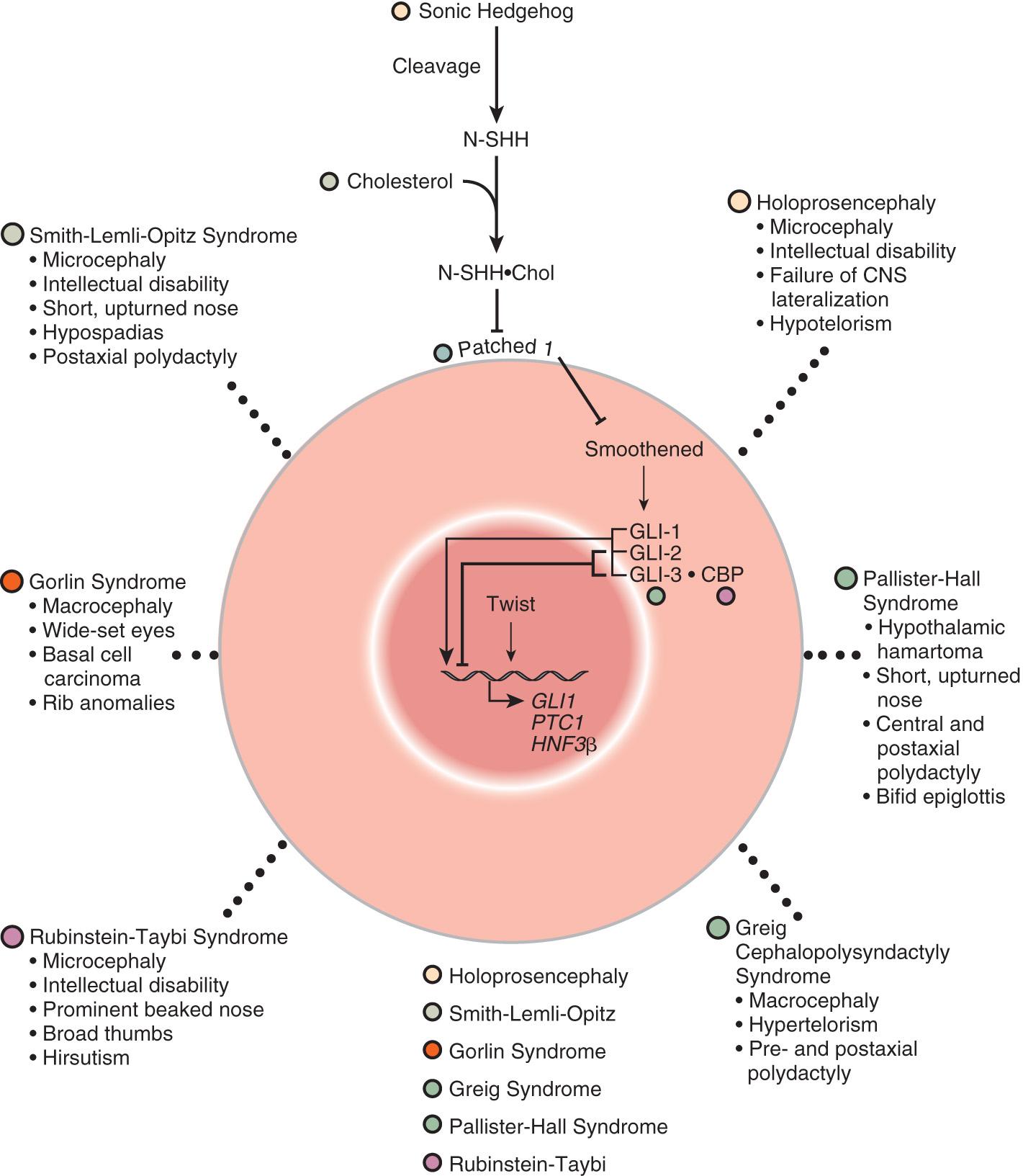 Fig. 128.2, Deleterious sequence variants in genes that function together in a developmental pathway typically have overlapping clinical manifestations.