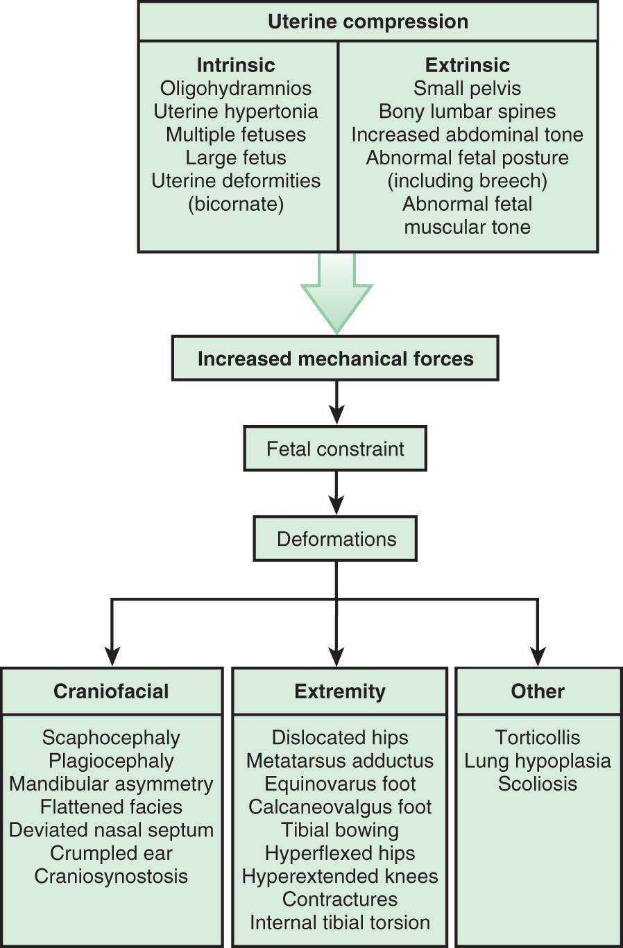 Fig. 128.4, Deformation abnormalities resulting from uterine compression.