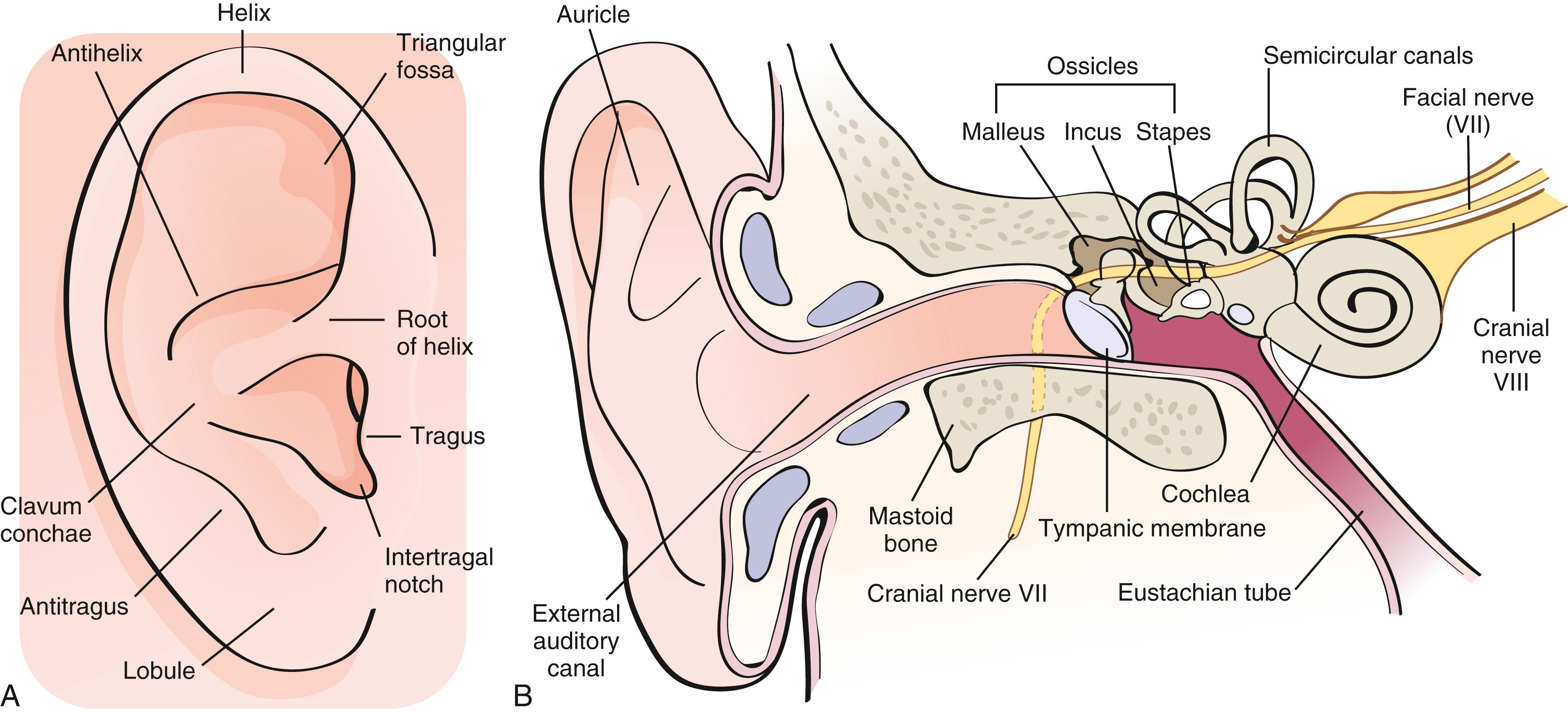 Fig. 5.1, Anatomy of the ear. A, A normal external ear (auricle or pinna) is shown, with its various landmarks labeled. It is helpful to refer to such a diagram in assessing congenital anomalies. B, This coronal section shows the various structures of the hearing and vestibular apparatus. The three main regions are the external ear, middle ear, and inner ear. The eustachian tube connects the middle ear and the nasopharynx and serves to drain and ventilate the middle ear.