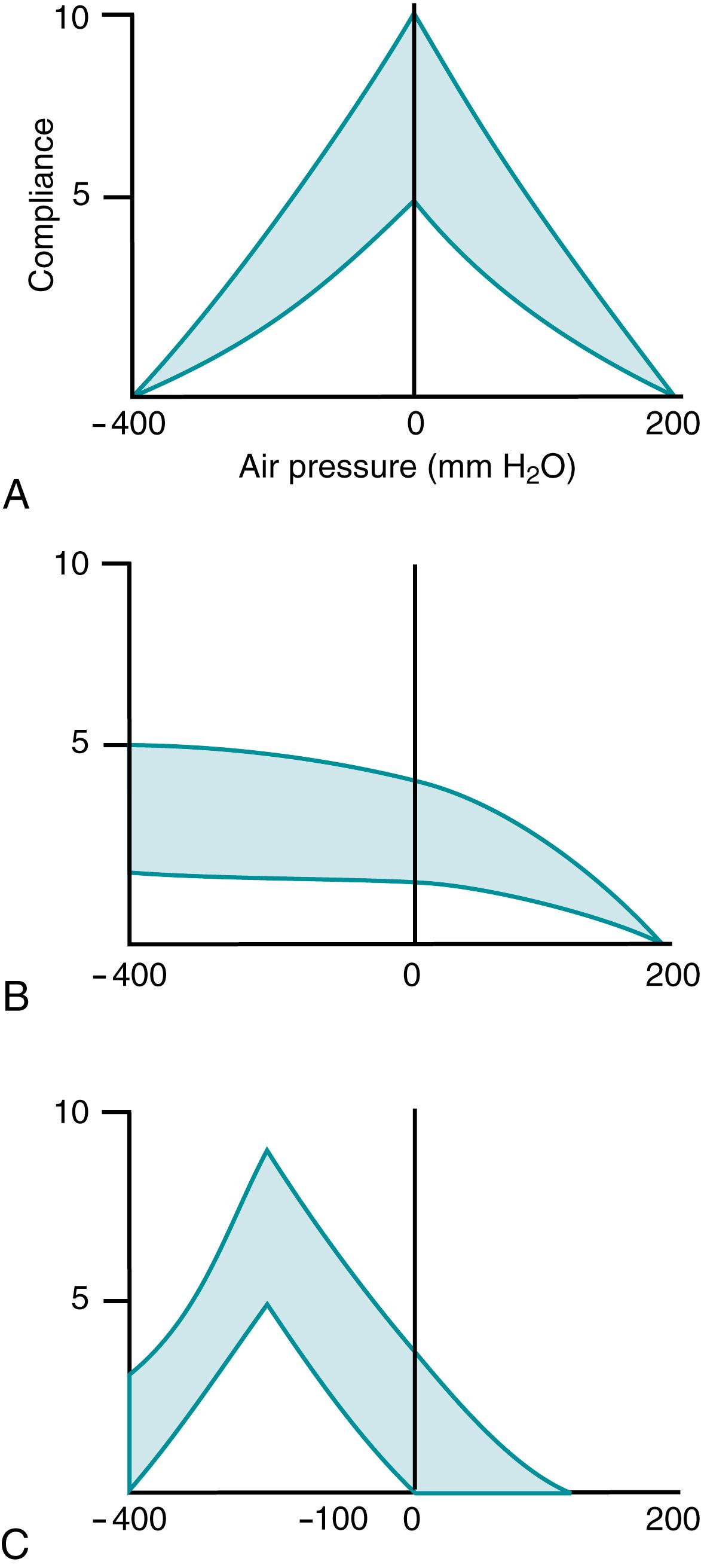 Fig. 5.6, A , A normal tympanogram with a peak at atmospheric pressure, indicating an air-filled middle ear with normal (atmospheric) pressure. B , A “flat” tympanogram, indicating middle ear effusion. C , A tympanogram with a negative peak pressure, indicating eustachian tube obstruction.