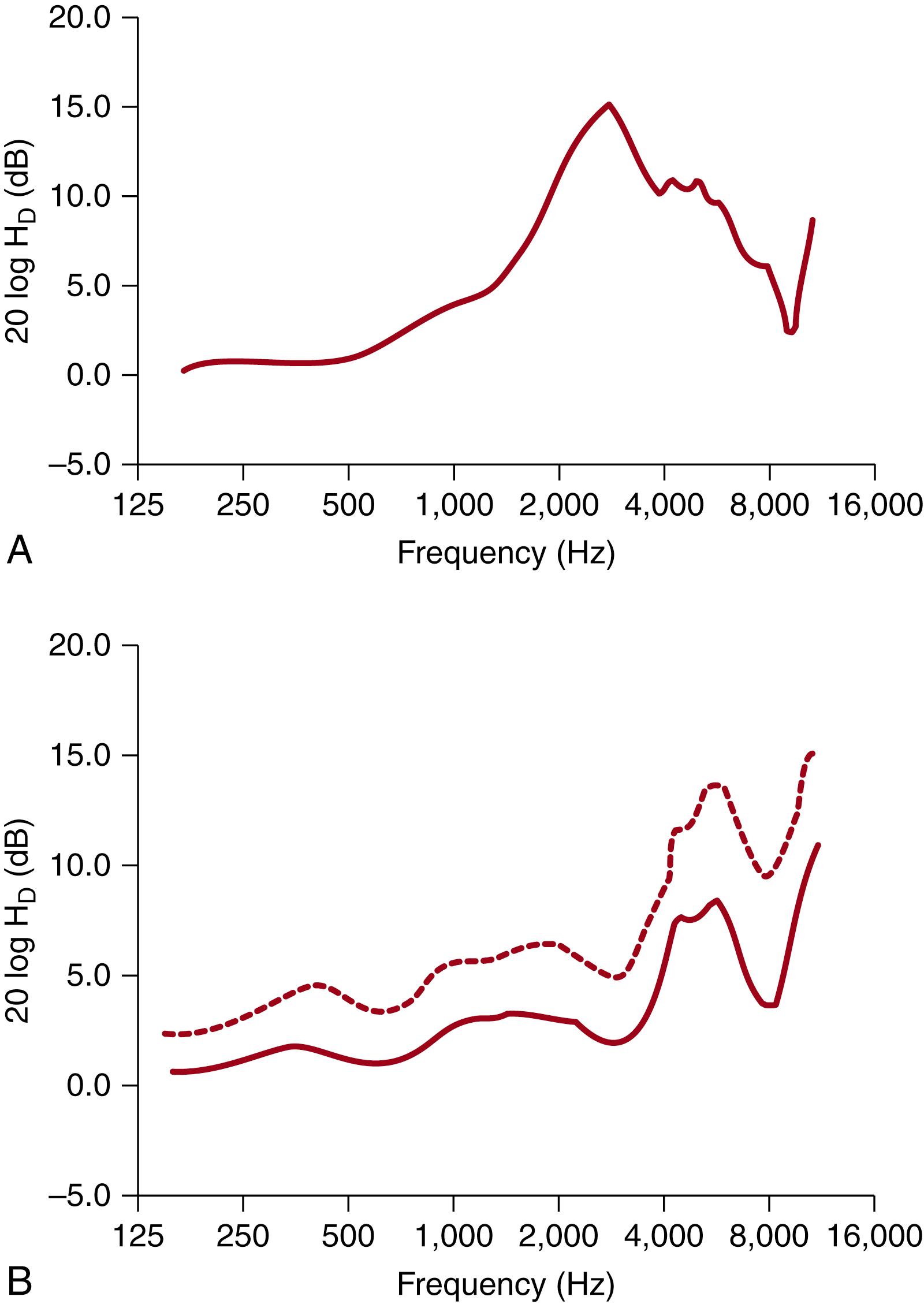 Fig. 135.5, Diffuse field sound-source to eardrum acoustic transfer functions measured in a KEMAR human adult manikin (A) and for 1-month-old infants (B). In panel (B) the solid line is the across-subject average transfer function and the dashed line is the average plus 1 SD. H D , Diffuse field transfer function magnitude.