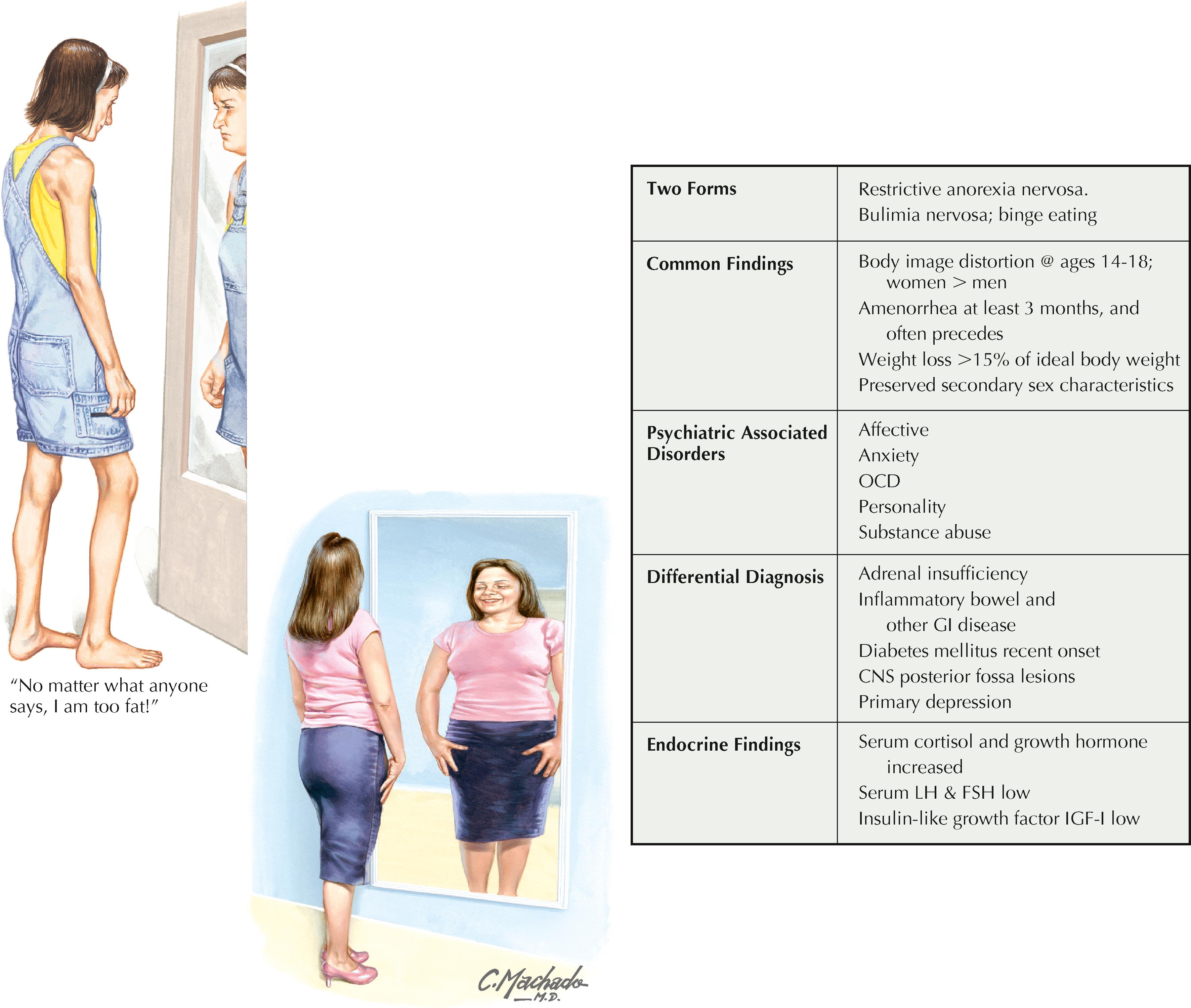 Figure 27.1, Eating disorders.