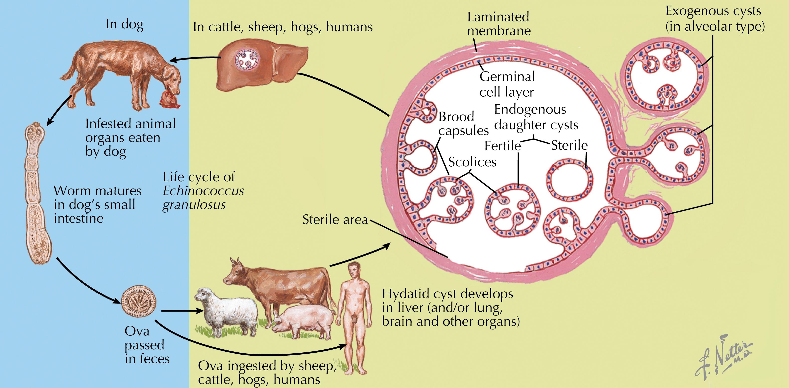 Fig. 85.1, Life cycle of Echinococcus granulosus , with detail showing development of endogenous daughter cysts from a primary cyst in the liver. Although the life cycle of Echinococcus multilocularis is not shown, the formation of exogenous cysts by evagination of the primary cyst wall is illustrated to show the difference in cyst formation (the hydatid daughter cysts lack the pericyst layer, whereas the alveolar cysts retain this membrane layer).