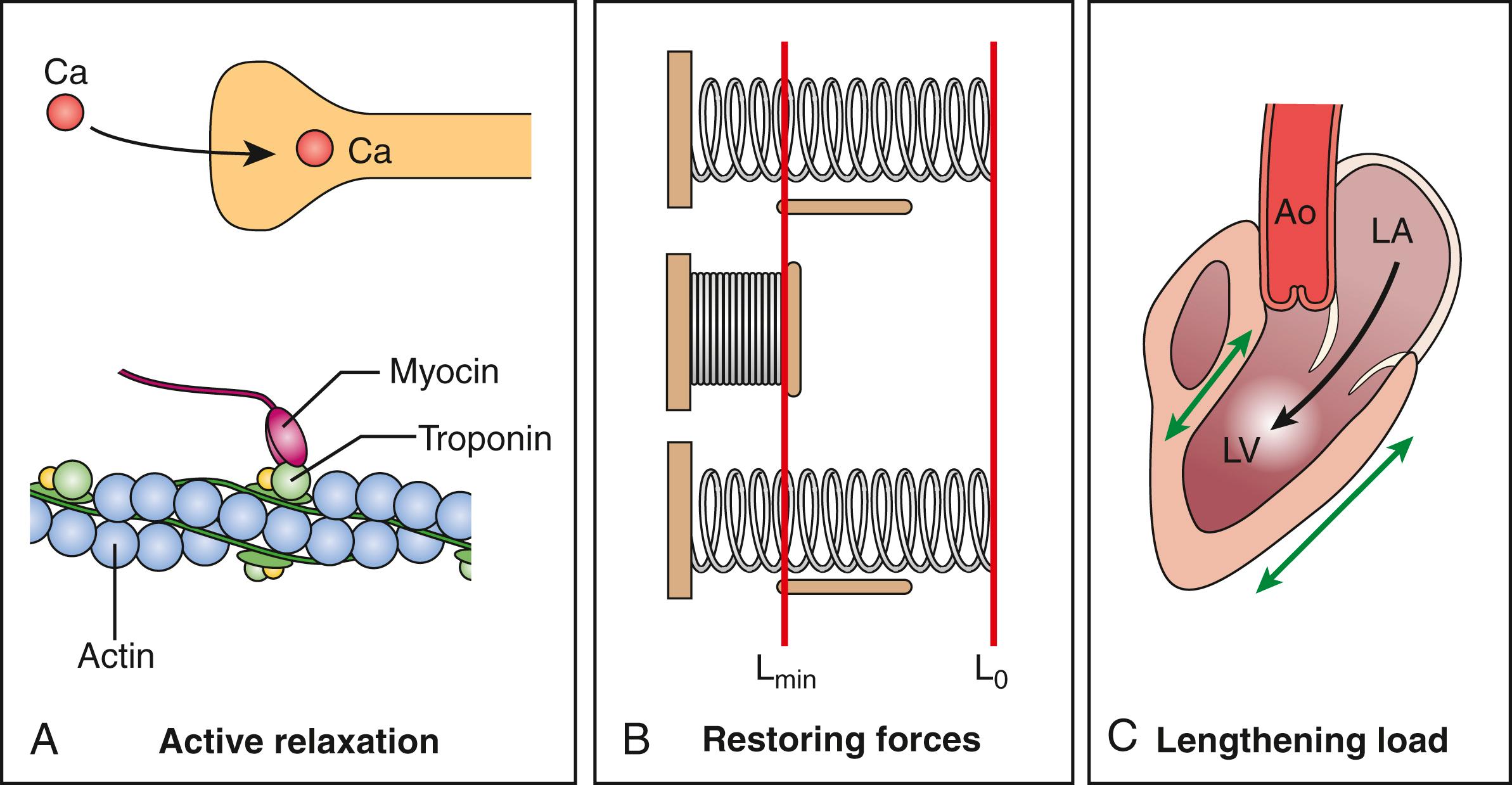 Figure 179.2, The three independent determinants of e′, which are left ventricular relaxation, restoring forces, and lengthening load. A, Rate of relaxation reflects decay of active fiber force. B, Restoring forces, which account for diastolic suction, are illustrated by an elastic spring, which is compressed to a dimension (L min ) less than its resting length (L 0 ) and recoils back to resting length when the compression is released. C, Lengthening load is the pressure in the left atrium at mitral valve opening, which “pushes” blood into the left ventricle (LV) and thereby lengthens the ventricle. AO, Aorta; LA, left atrium.