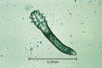 Fig. 5.16, Ventral view of Demodex folliculorum .