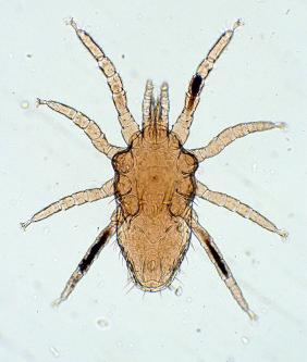 Fig. 5.3, Ornithonyssus bursa , the tropical fowl mite.