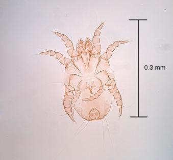 Fig. 5.6, Dermatophagoides male.