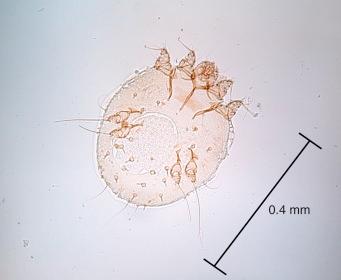 Fig. 5.7, Female scabies mite.