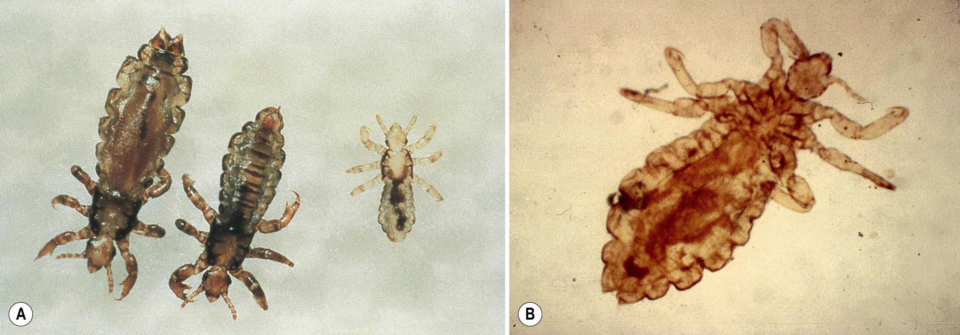 FIGURE 257.2, (A–B) Pediculus humanus (head and body louse).