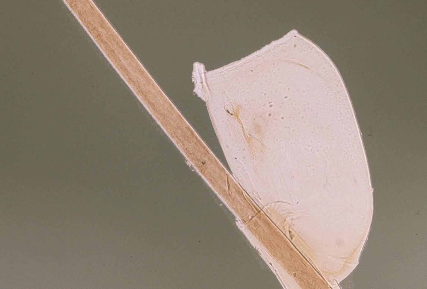 FIGURE 257.3, Empty egg case on shaft of hair.