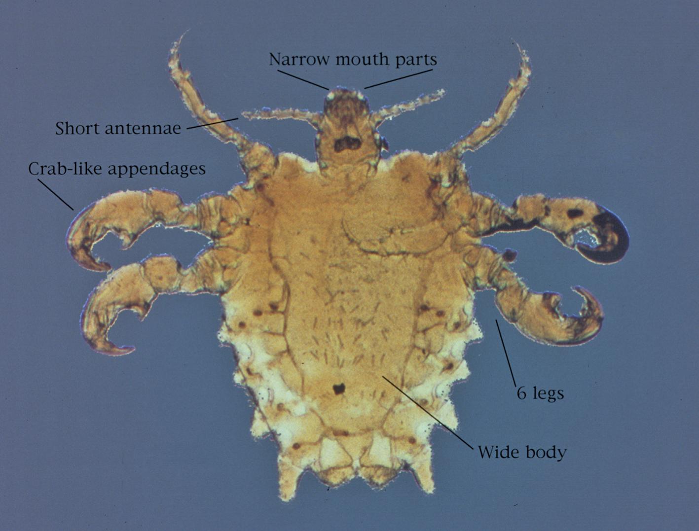 FIGURE 257.4, Phthirus pubis (crab louse).
