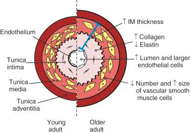 Figure 16-1, Remodeling of the central elastic arteries with age. The layers of the arterial wall are labeled as shown. There are marked changes in central elastic arteries as a consequence of the aging process. The diameter of the lumen increases with age. Intima plus media (IM) thickness also increases, primarily as a consequence of an increase in the thickness of the tunica intima. An increase in collagen deposition and decrease in elastin are responsible for intimal remodeling in aging arteries. The number of vascular smooth muscle cells in the tunica media decreases, whereas the remaining cells hypertrophy. Endothelial cell hypertrophy also occurs in aging arteries.