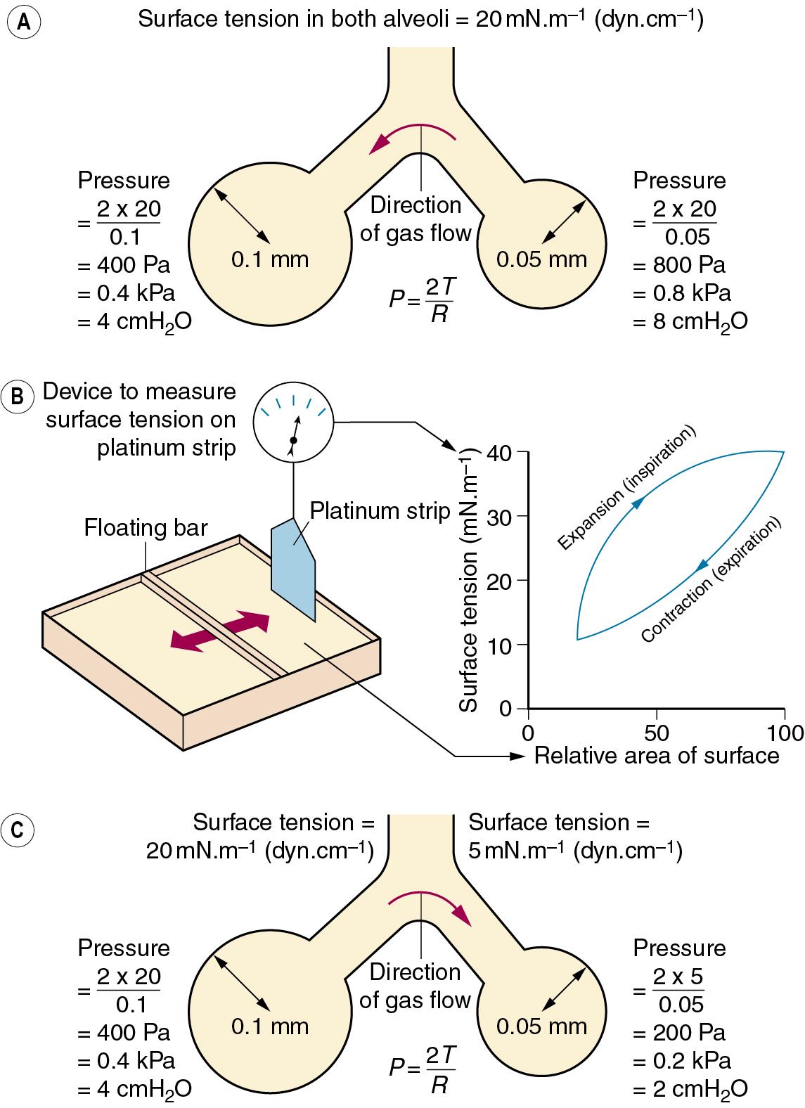 • Fig. 2.1, Surface tension and alveolar transmural pressure. (A) Pressure relations in two alveoli of different size but with the same surface tension of their lining fluids. (B) The changes in surface tension in relation to the area of the alveolar lining film. (C) Pressure relations of two alveoli of different size when allowance is made for the probable changes in surface tension induced by surfactant.