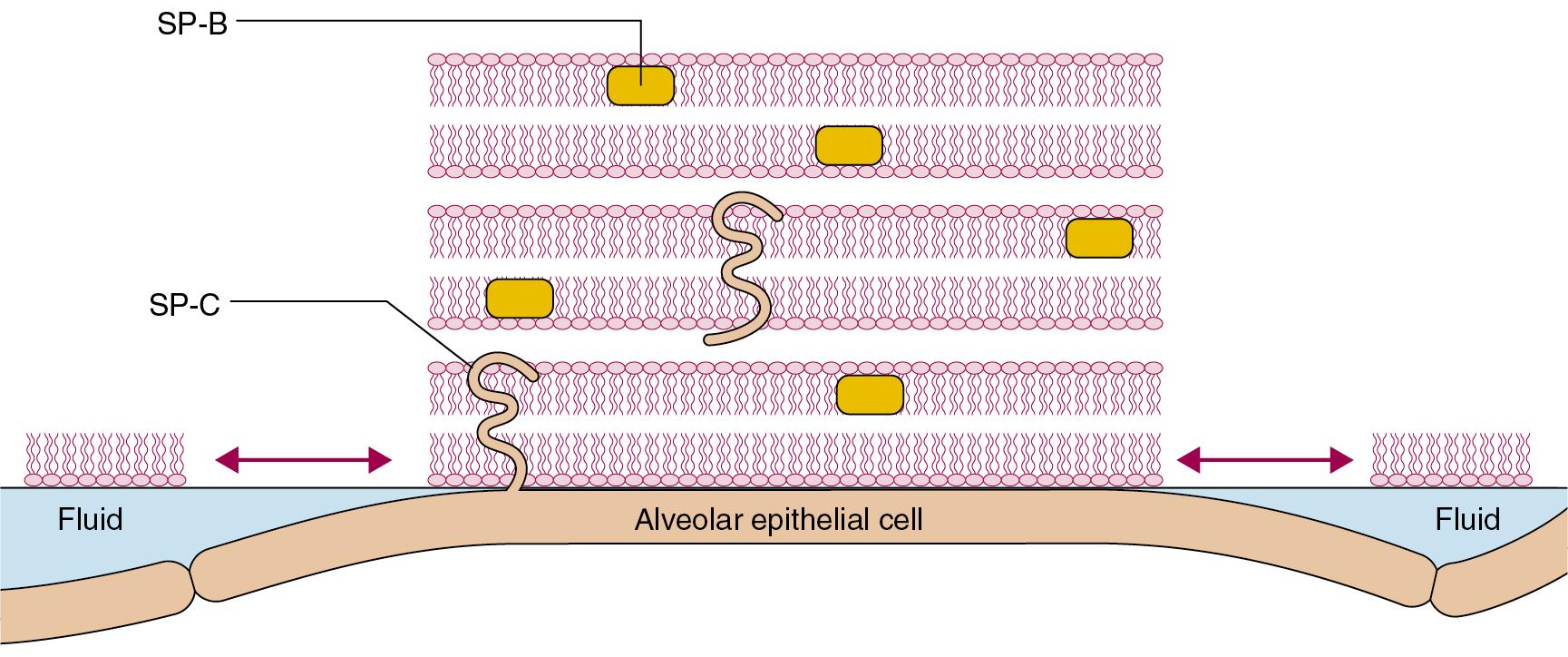 • Fig. 2.2, Morphological model of alveolar surfactant. Multilayered, less wettable rafts of surfactant are interspersed with fluid pools. Surfactant proteins lie within (SP-B) or across (SP-C) the lipid bilayers, facilitating the formation and dispersion of the rafts with each breath to modify the surface forces within the alveolus.