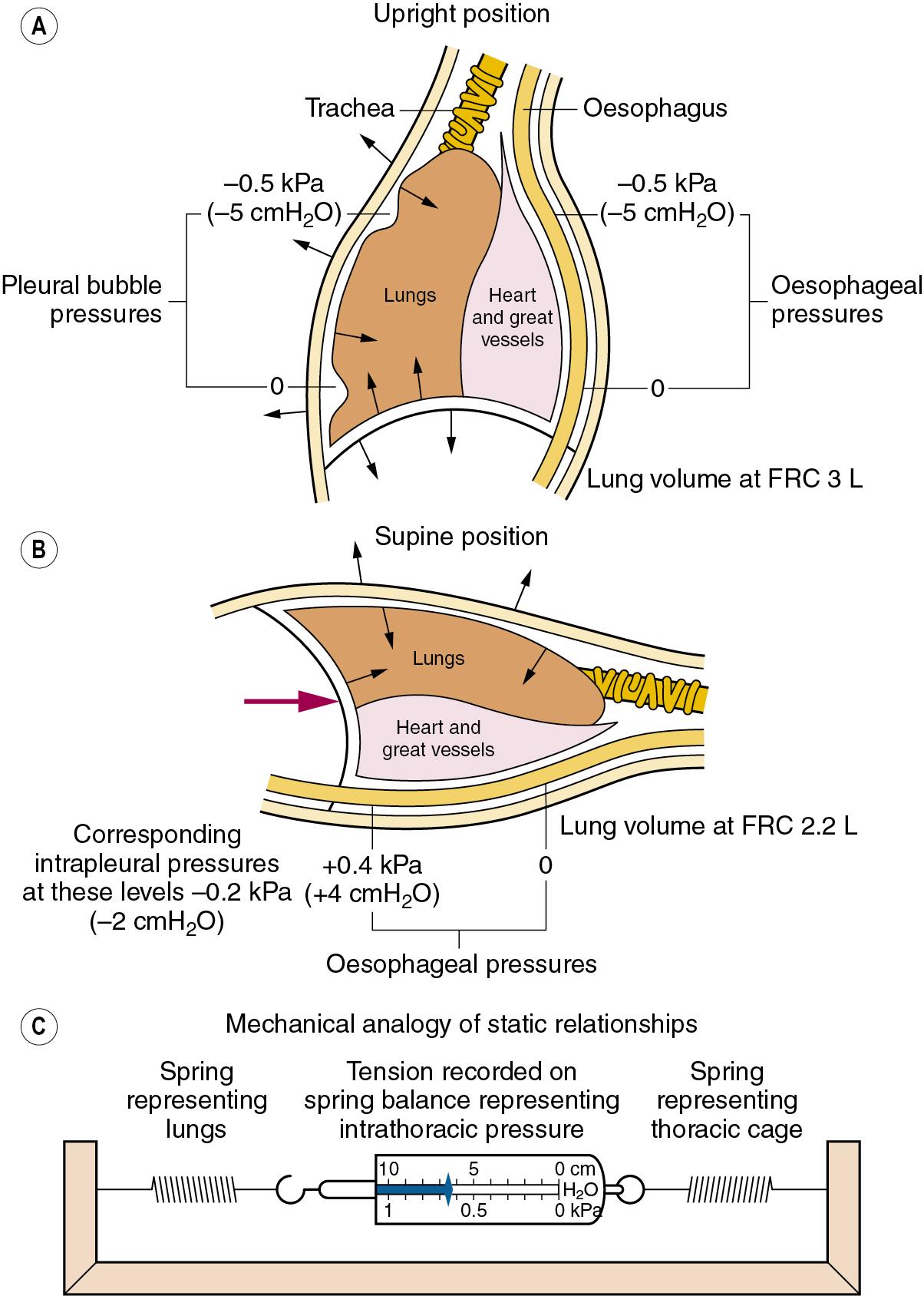 • Fig. 2.4, Intrathoracic pressures: static relationships in the resting end-expiratory position. The lung volume corresponds to the functional residual capacity (FRC) . (A) and (B) indicate the pressure relative to ambient (atmospheric). Arrows show the direction of elastic forces. The heavy arrow in (B) indicates displacement by the abdominal viscera. (C) The tension in the two springs is the same and will be indicated on the spring balance. In the supine position: 1, the FRC is reduced; 2, the intrathoracic pressure is raised; 3, the weight of the heart raises the oesophageal pressure above the intrapleural pressure.