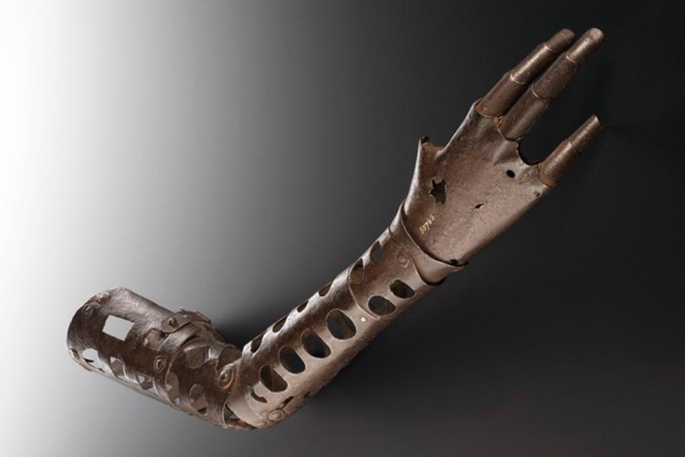 FIG 85.1, A 16th-century upper extremity exoprosthesis was used to engage in hand-to-hand combat.