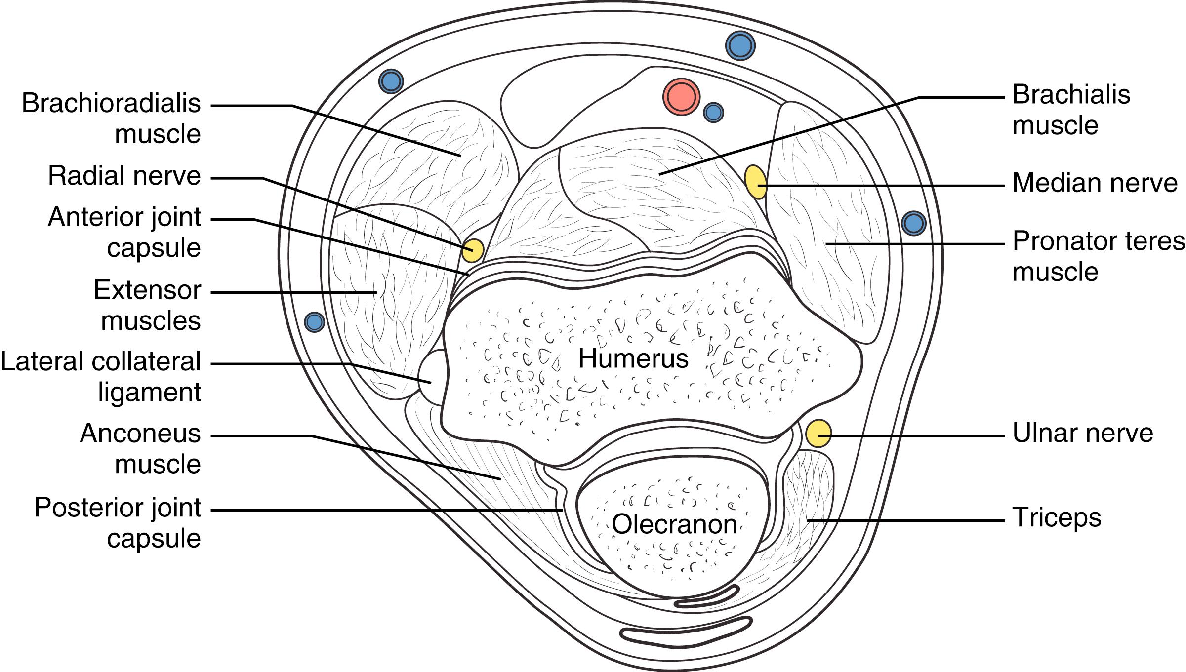 Fig. 26.4, The three major nerves to the hand all cross the elbow and are in close proximity to arthroscopic portals and the joint capsule.