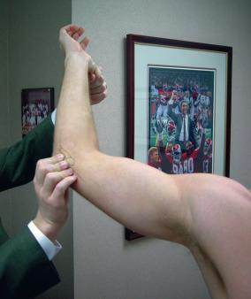 Fig. 64.4, The milking maneuver, which is used to test the integrity of the ulnar collateral ligament.