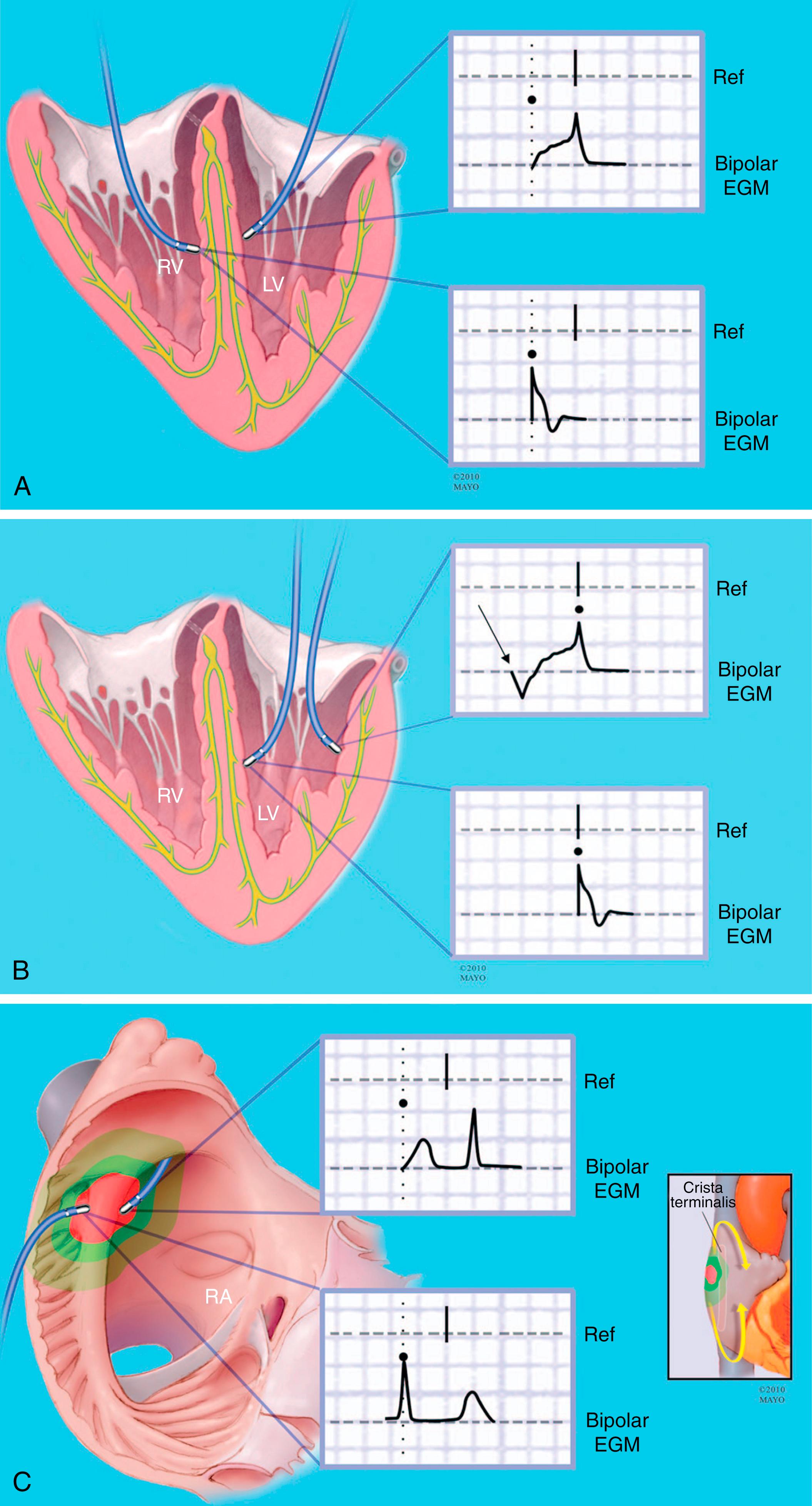 Fig. 128.4, Pitfalls to different methods of point annotation.