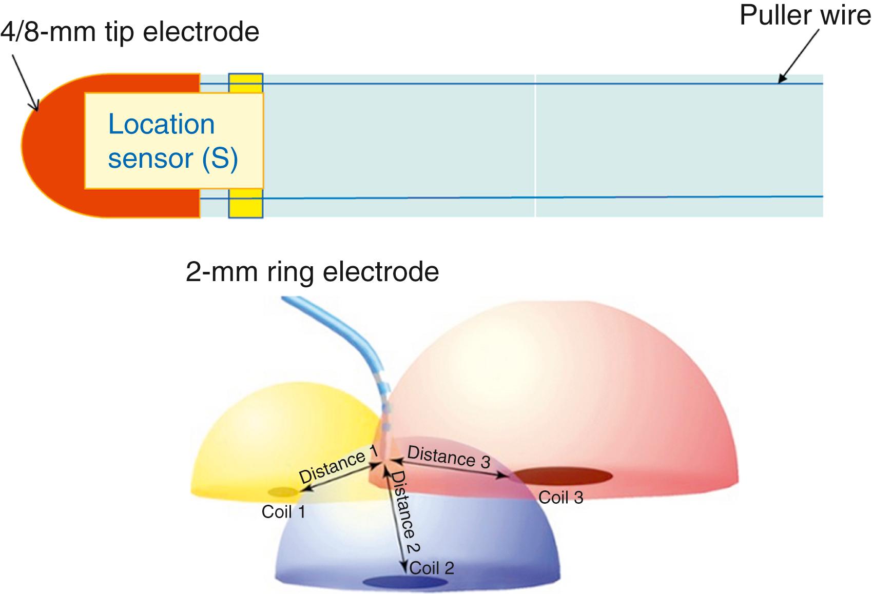 Fig. 128.7, Schematic of how the CARTO system localizes the sensor-based catheter using magnetic fields.