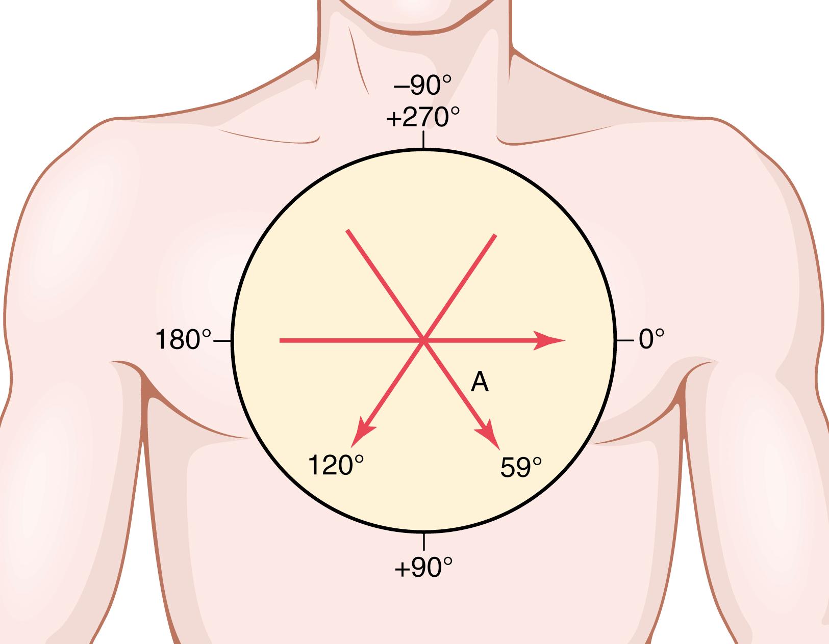 Figure 12-2, Vectors drawn to represent potentials for several different hearts and the axis of the potential (expressed in degrees) for each heart.