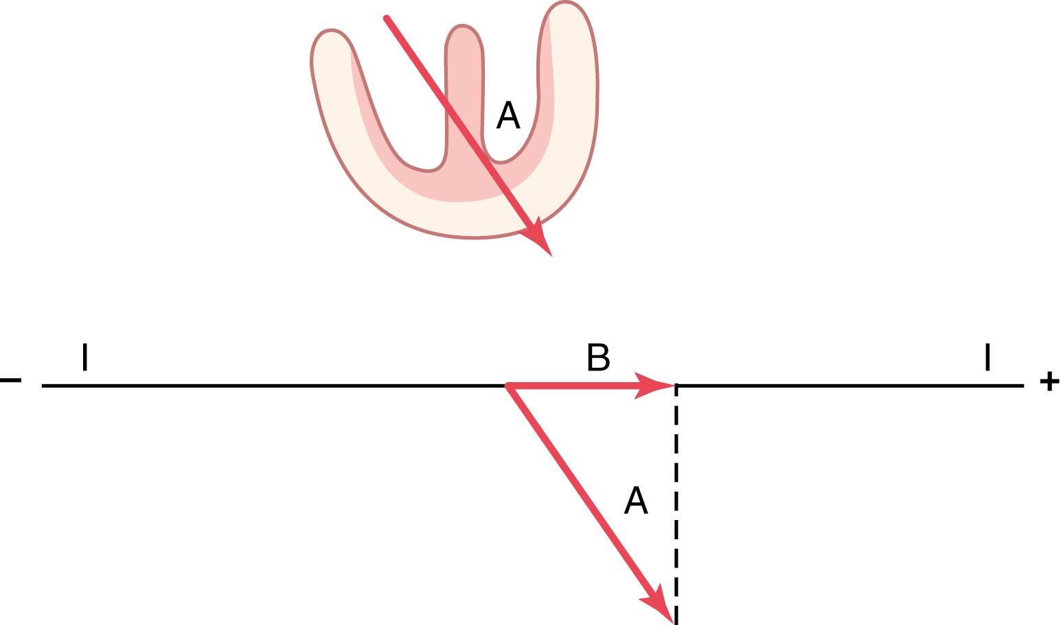 Figure 12-4, Determination of a projected vector B along the axis of lead I when vector A represents the instantaneous potential in the ventricles.