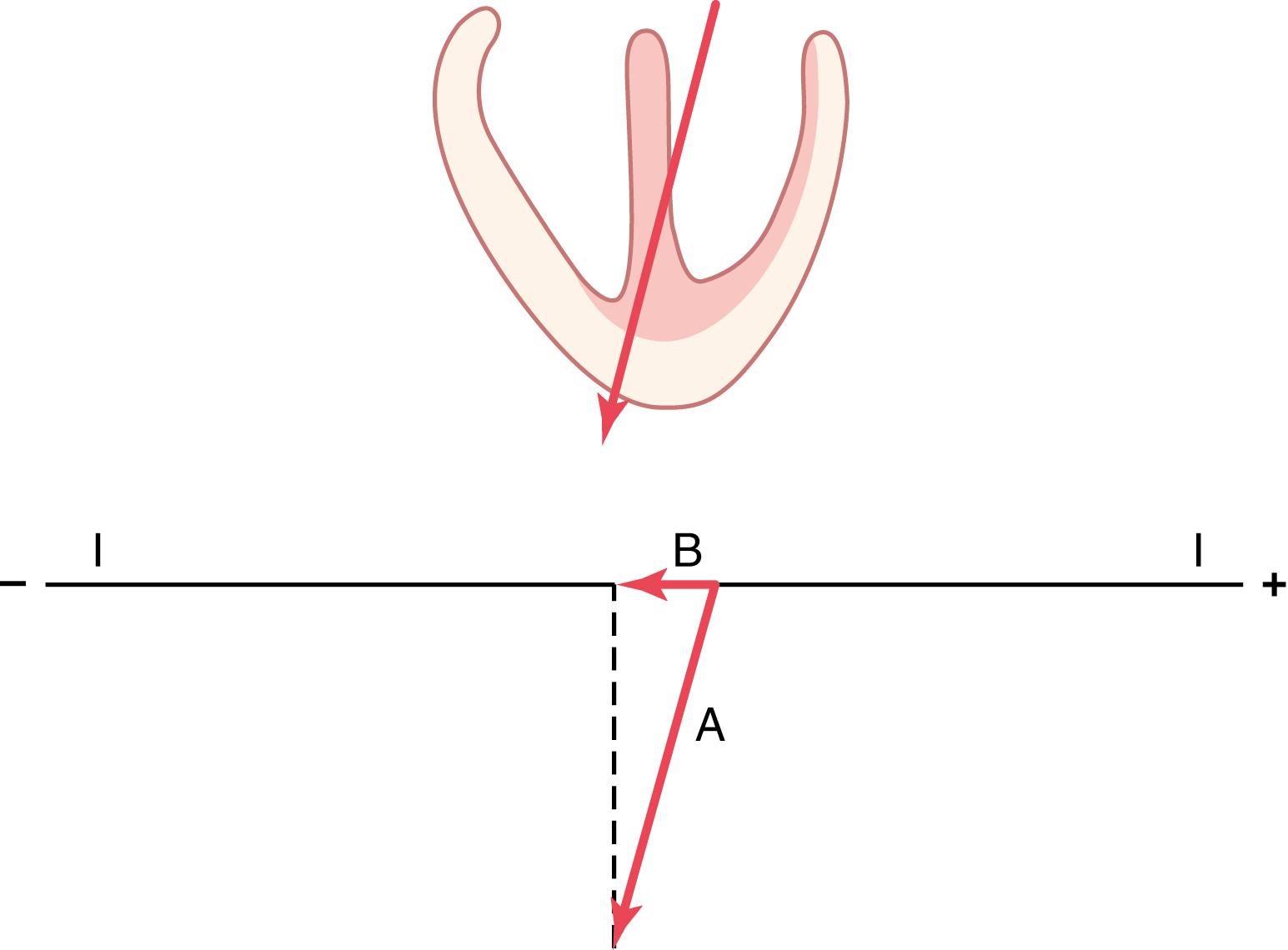 Figure 12-5, Determination of the projected vector B along the axis of lead I when vector A represents the instantaneous potential in the ventricles.