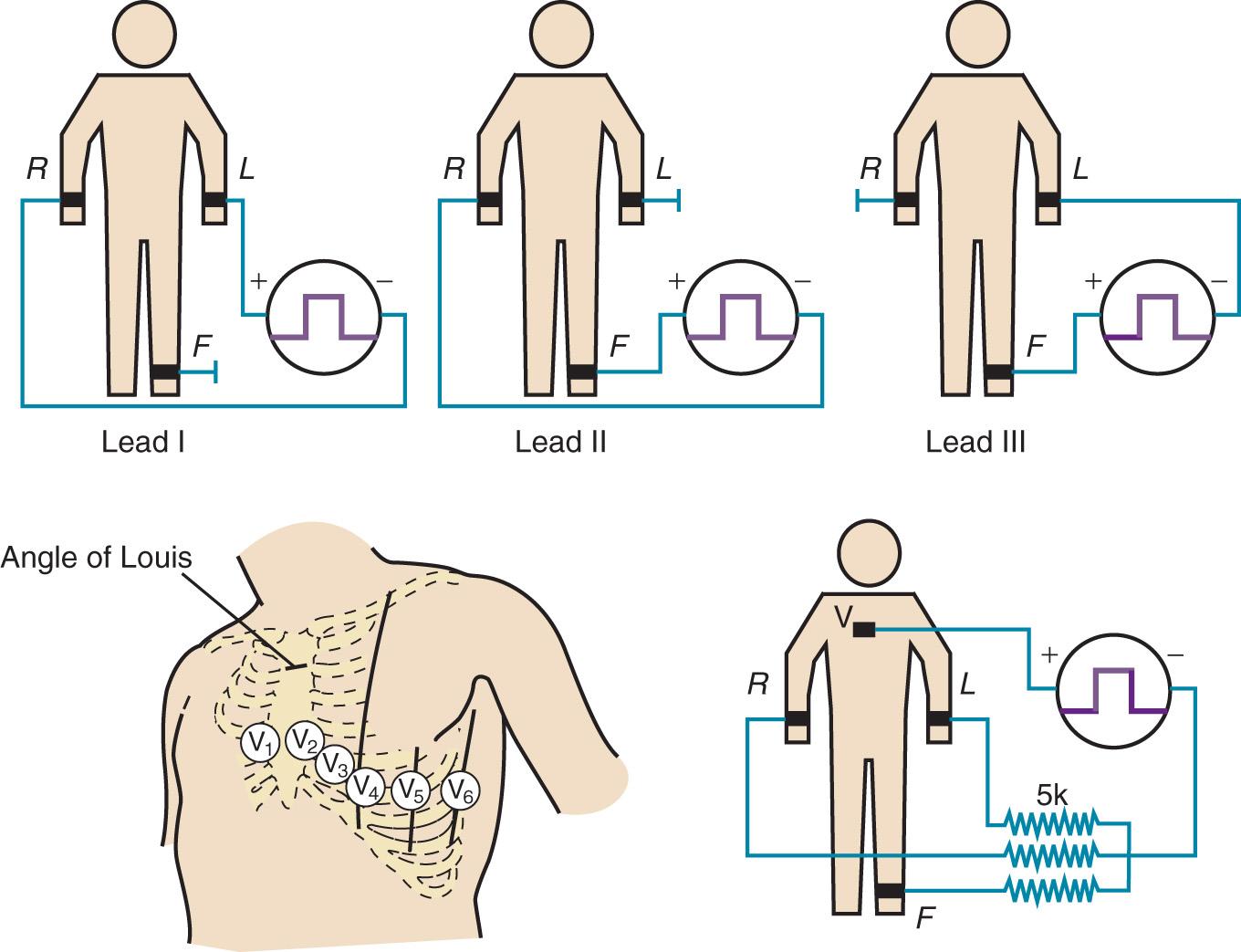 Fig. 9.1, (Top) Electrode connections for recording the three standard limb leads I, II, and III. R, L, and F indicate locations of electrodes on the right arm, the left arm, and the left foot, respectively. (Bottom) Electrode locations and electrical connections for recording a precordial lead. (Left) The positions of the exploring electrode (V) for the six precordial leads. (Right) Connections to form the Wilson central terminal for recording a precordial (V) lead.