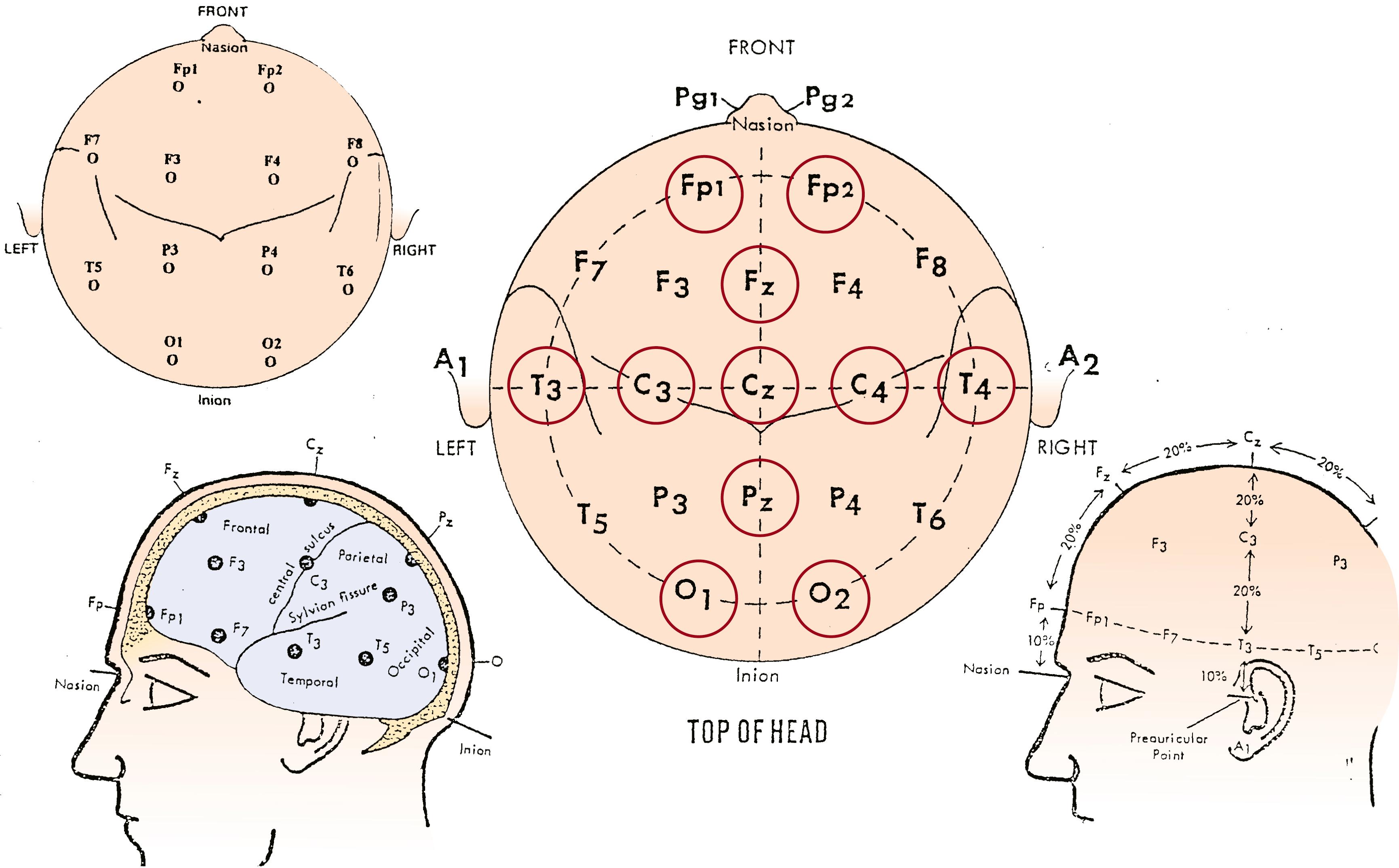 Fig. 130.1, The International 10 to 20 System for electrode placement, modified for neonates. Electrode positions circled in red are included in the typical neonatal montage.