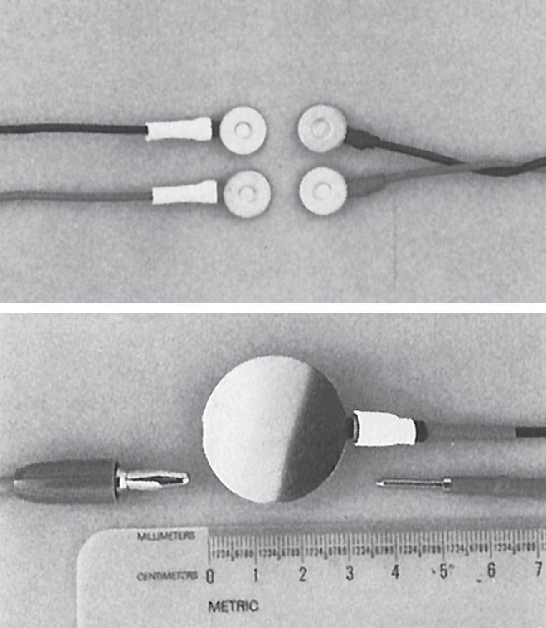 Figure 19.6, Disk surface electrodes and a ground electrode are used for the measurement of motor nerve conduction velocity. (Courtesy of Oxford Instruments Medical, Inc., Hawthorne, NY.)