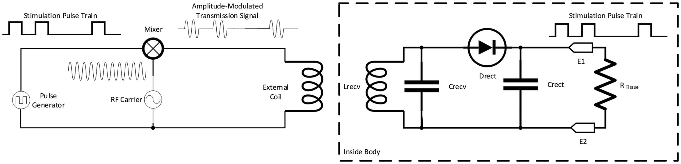 Figure 9.3, Simple transcutaneous radiofrequency (RF) neurostimulator system.