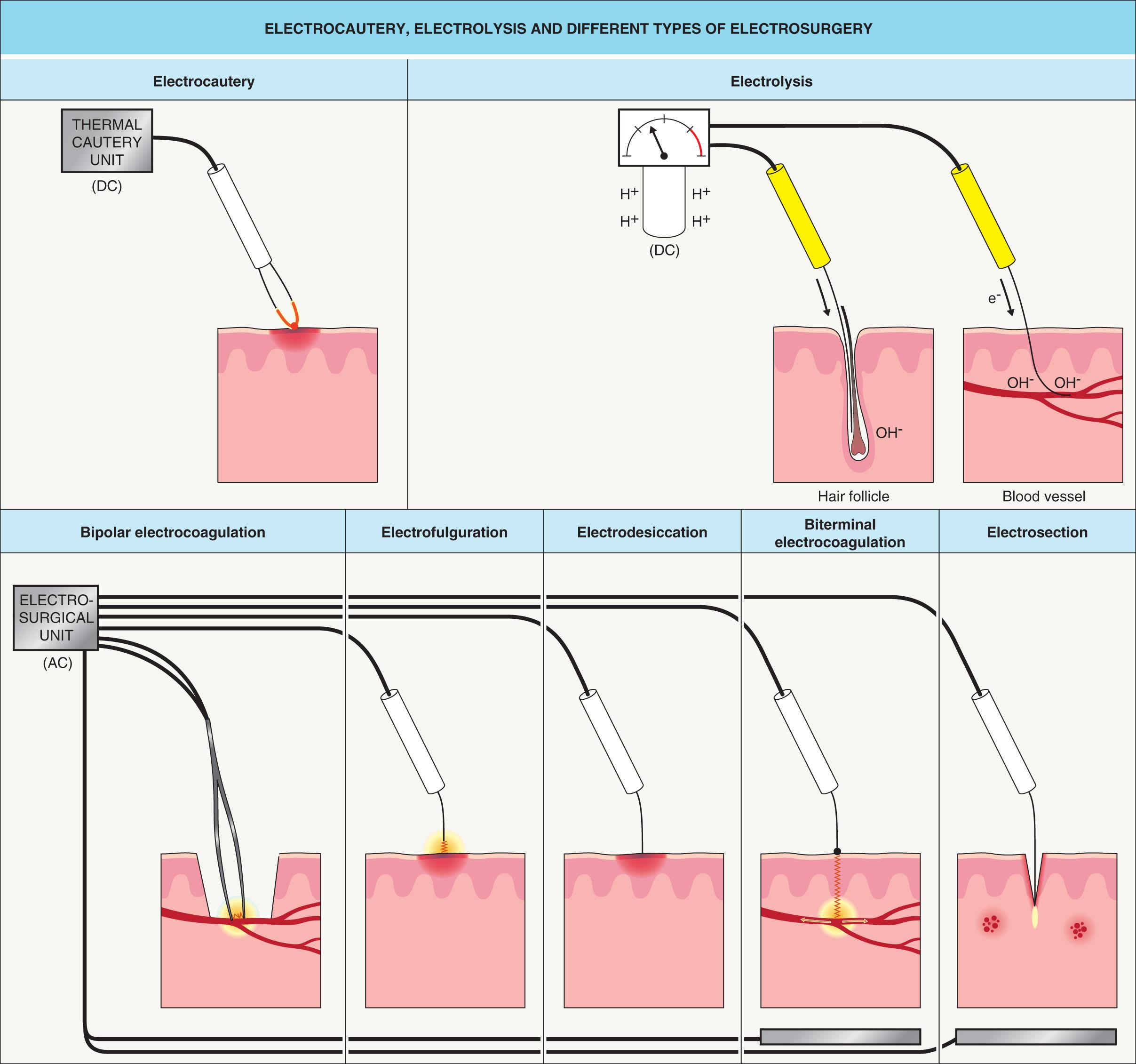 Electrosurgery Clinical Tree