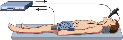 FIG 6.5, A monopolar accessory circuit.