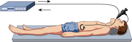 FIG 6.6, A bipolar accessory circuit.