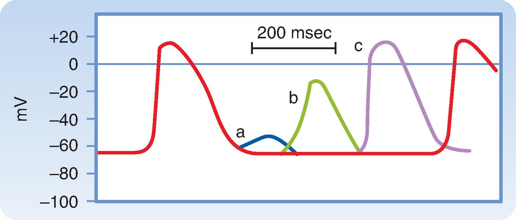 Fig. 16.13, Effects of excitation at various times after the initiation of an action potential in a slow-response fiber. In this fiber, excitation very late in phase 3 (or early in phase 4) induces a small, nonpropagated (local) response (wave a). Later in phase 4, a propagated response (wave b) can be elicited, but its amplitude is small and the upstroke is not very steep; this response is conducted very slowly. Still later in phase 4, full excitability is regained, and the response (wave c) displays normal characteristics.
