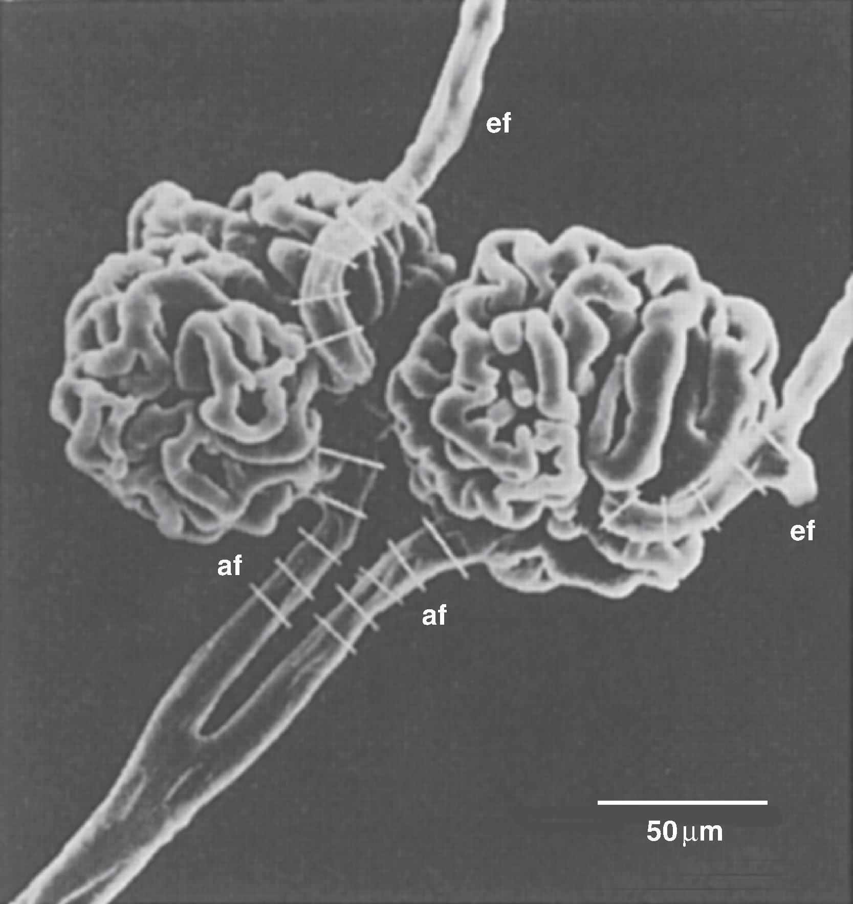 Fig. 33.6, Scanning electron micrograph of the interlobular artery, afferent arteriole (af) , efferent arteriole (ef) , and glomerulus. The white bars on the afferent and efferent arterioles indicate that they are about 15 to 20 µm in diameter.