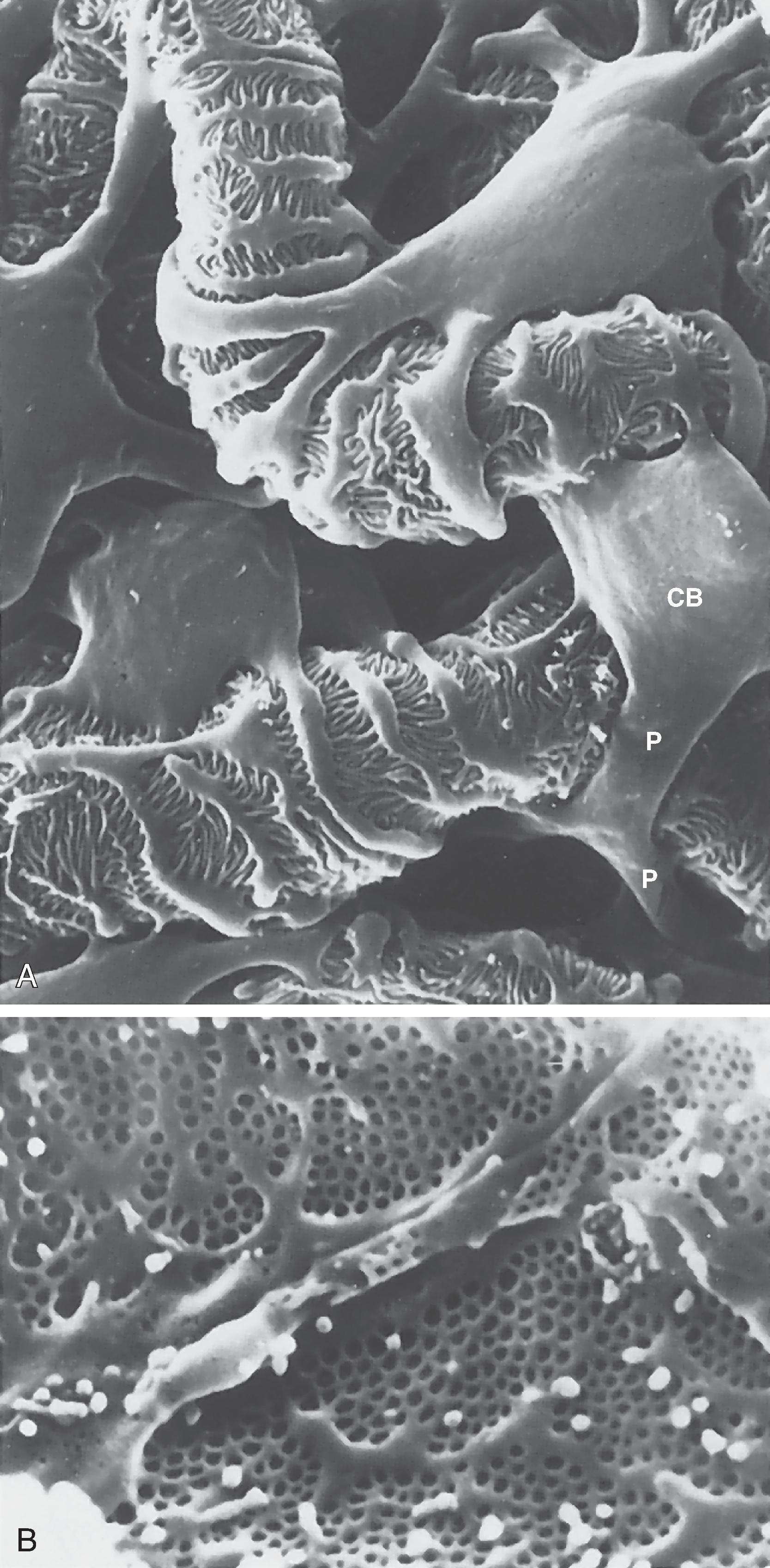 Fig. 33.8, A, Scanning electron micrograph showing the outer surface of glomerular capillaries. This is the view that would be seen from Bowman’s space. Processes (P) of podocytes run from the cell body (CB) toward the capillaries, where they ultimately split into foot processes. Interdigitation of the foot processes creates the filtration slits. B, Scanning electron micrograph of the inner surface (blood side) of a glomerular capillary. This view would be seen from the lumen of the capillary. The fenestrations of the endothelial cells are seen as small 700-Å holes.