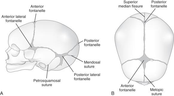 Figure 18.1, Schematics of the cranium at birth showing the greater and lesser fontanelles. Lateral (A) and superior (B) views.