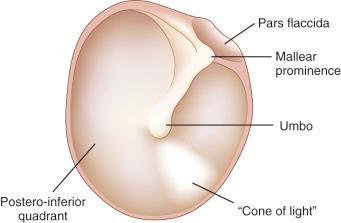 Fig. 22-3, External (lateral) aspect of the tympanic membrane (eardrum).