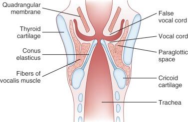 Fig.14-5, Coronal view of the larynx.