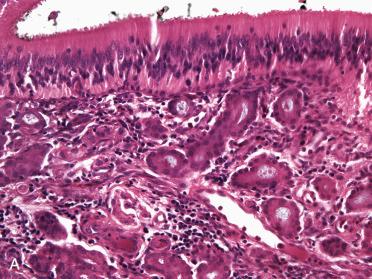 Fig. 1-4, Olfactory mucosa.