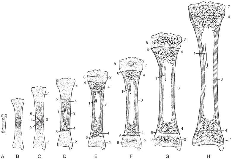 Figure 128.1, Schema of progressive stages in the growth and maturation of the tibia.