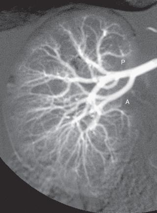 e-Figure 110.9, Normal renal arterial anatomy.