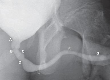 e-Figure 110.13, Normal male urethra.