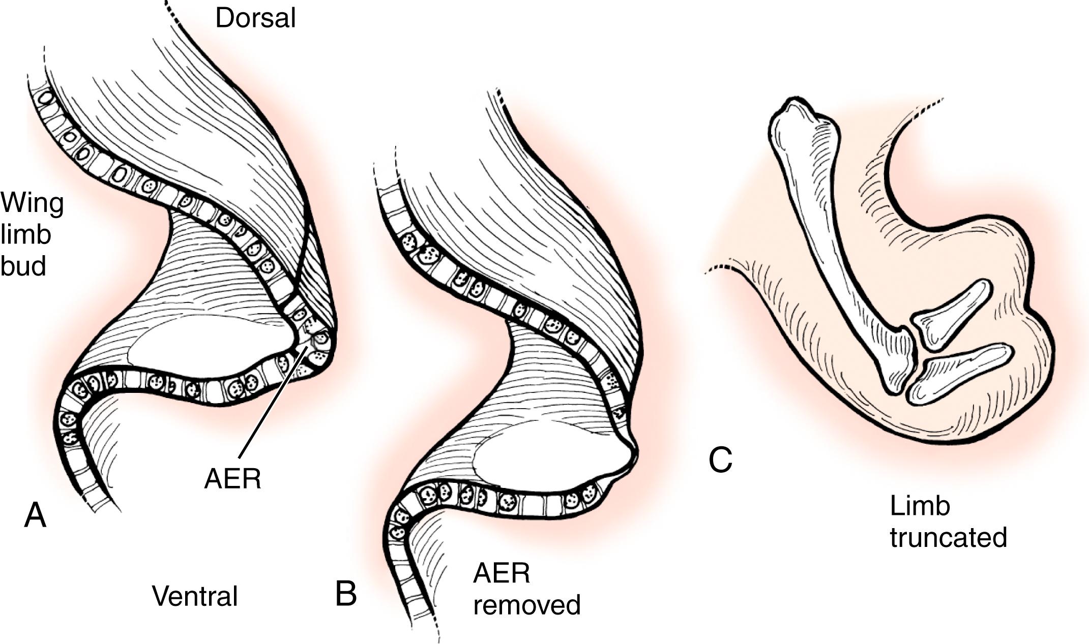 Fig. 35.4, Removal of the apical ectodermal ridge (AER) from the developing limb bud results in limb truncation.