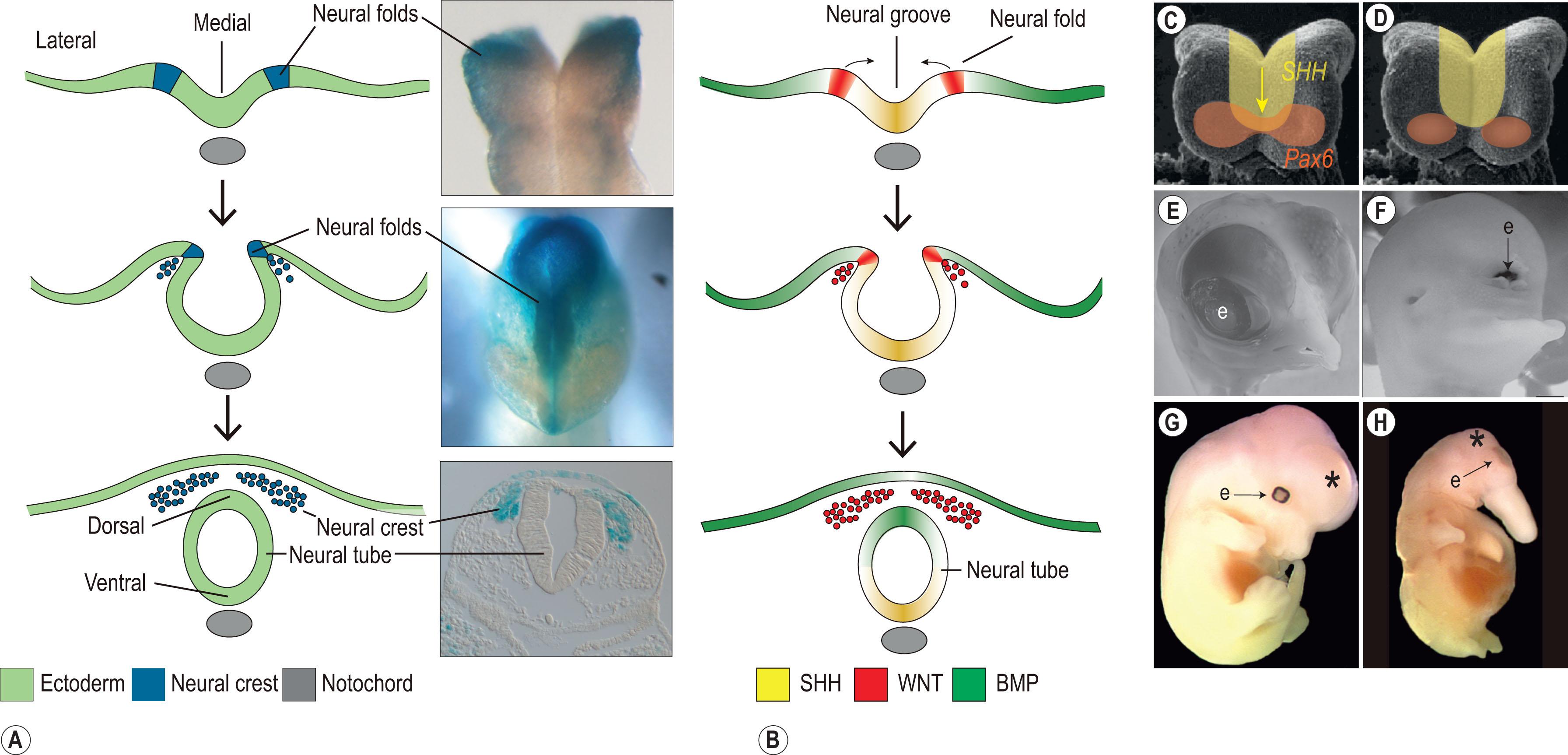 Figure 18.1, (A,B) Expression pattern of Sonic hedgehog (SHH, yellow), WNT (red) and BMP (green) signaling during the process of neurulation. (C) SHH expression (yellow) in the medial neural plate with Pax6 expression (orange) in the dumbbell-shaped area which corresponds to the feature eye field. (D) Subdivision of Pax6 expression into two bilateral domains through expression of SHH. (E) Wild-type chick embryo. (F) Chick embryo exhibiting cyclopia. (G) Wild-type mouse embryo at embryonic day 15.5. (H) Mouse embryo exhibiting cyclopia with proboscis as a result of loss of SHH in the neural plate which has led to persistence of a single Pax6 anterior midline. e, eye.