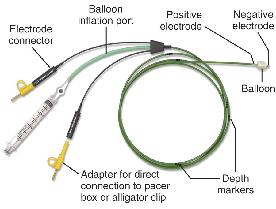 Figure 15.2, Balloon-tipped pacing catheter.