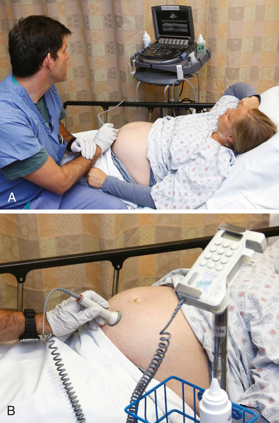 Figure 56.2, Assessment of fetal heart rate. A, Fetal assessment is often done via bedside ultrasonography in the emergency department. B, Traditional methods, such as external Doppler, are also acceptable. The normal baseline fetal heart rate is 110 to 160 beats/min.